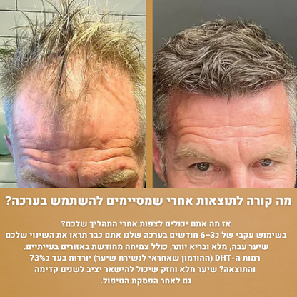 RootFix - ערכה לשיקום וצמיחה מחודשת של השיער